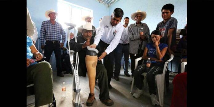 Entregan prótesis a lesionado. Entregan prótesis a lesionado.