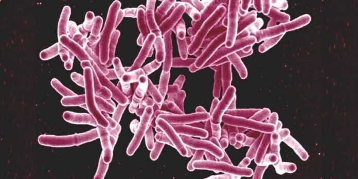 Mycobacterium, bacteria que causa la tuberculosis Mycobacterium, bacteria que causa la tuberculosis
