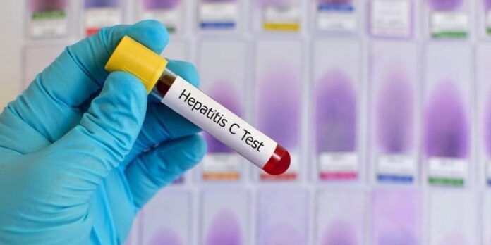 hepatitis-20d