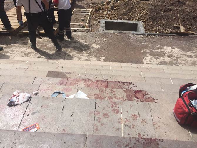 herido teatro 2