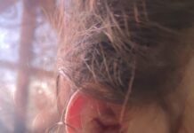 Niña resulta herida tras ser atacada por un perro en La Comarca