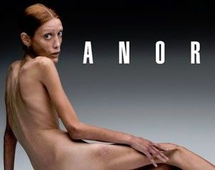 modeloanorexia-57e
